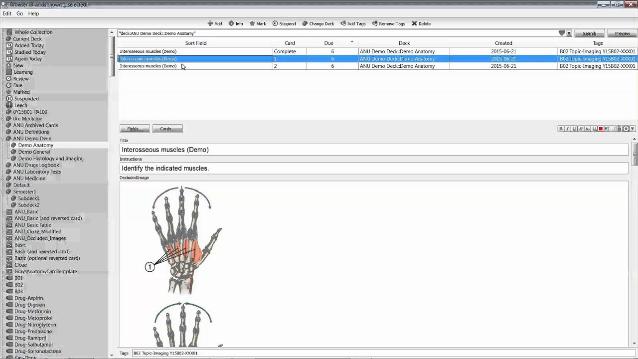 Create custom anki flashcards for studying by Lim_prats | Fiverr Create custom anki flashcards for studying by Lim_prats | Fiverr